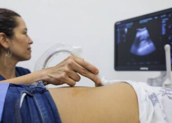 Se invita a la ciudadanía de Playa del Carmen a hacer uso de estudios de ultrasonido