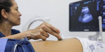 Se invita a la ciudadanía de Playa del Carmen a hacer uso de estudios de ultrasonido