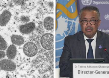 Declara OMS emergencia sanitaria internacional por brote de Mpox