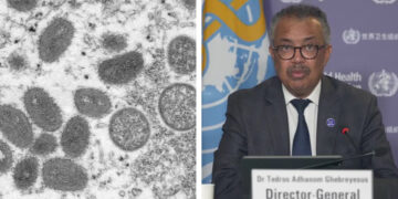 Declara OMS emergencia sanitaria internacional por brote de Mpox