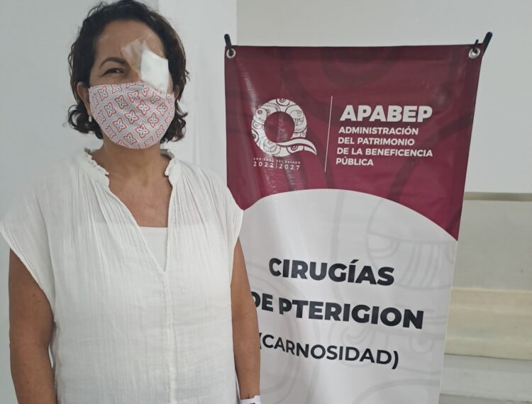 Benefician a portomorelenses con cirugías de Pterigión